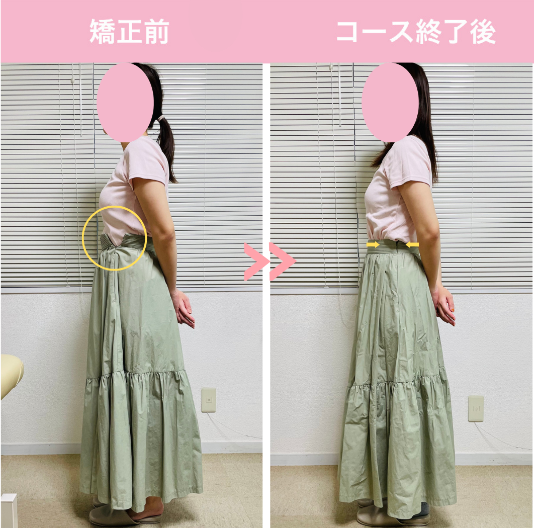 スカート
