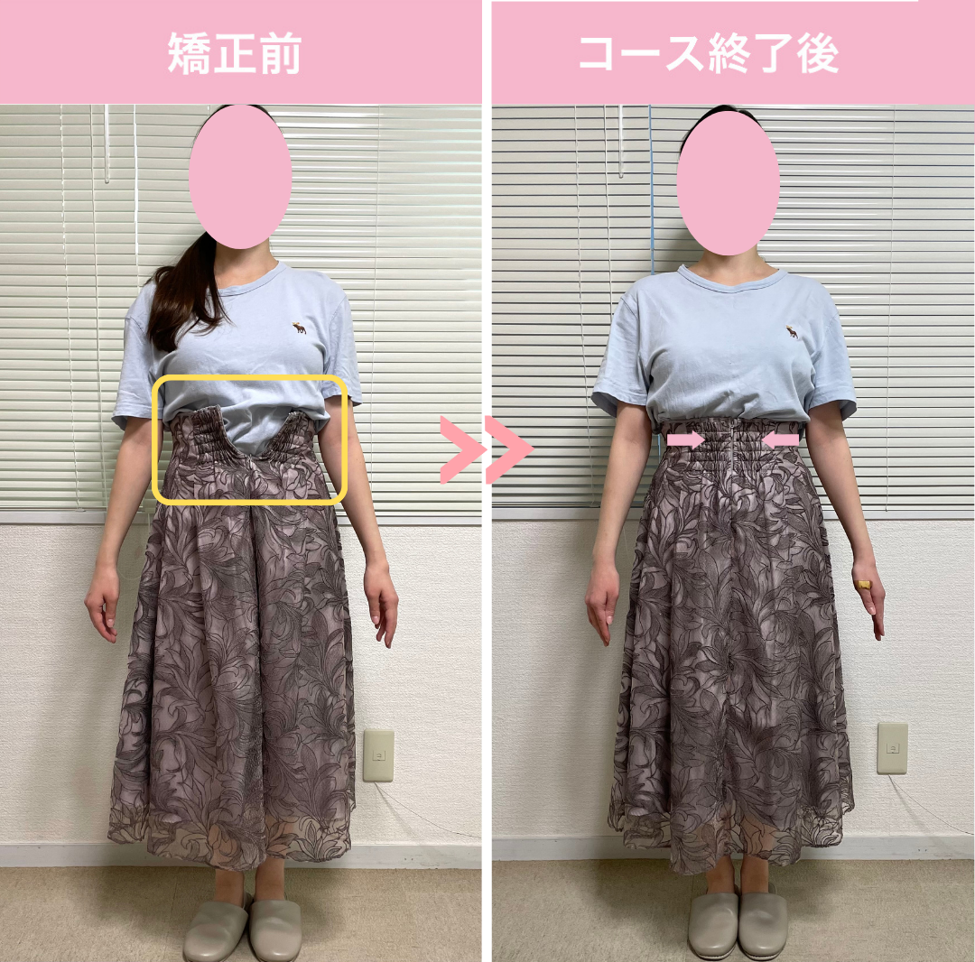 スカート