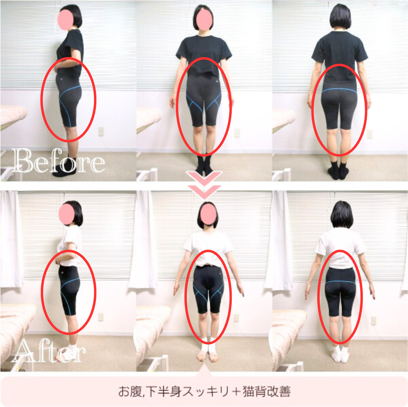 施術例