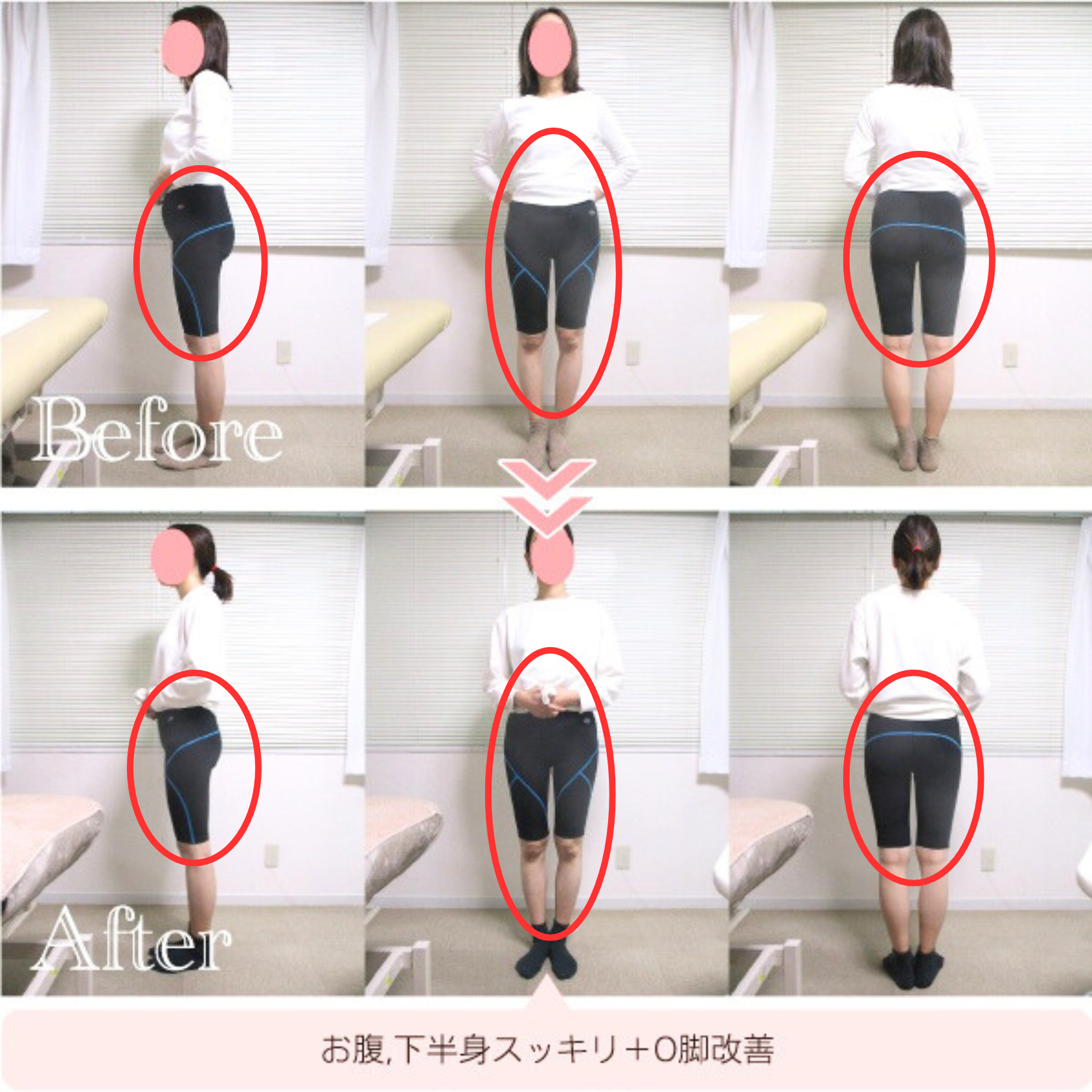 施術例