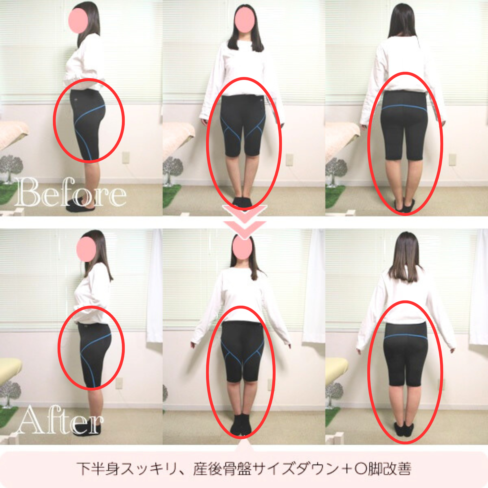 施術例
