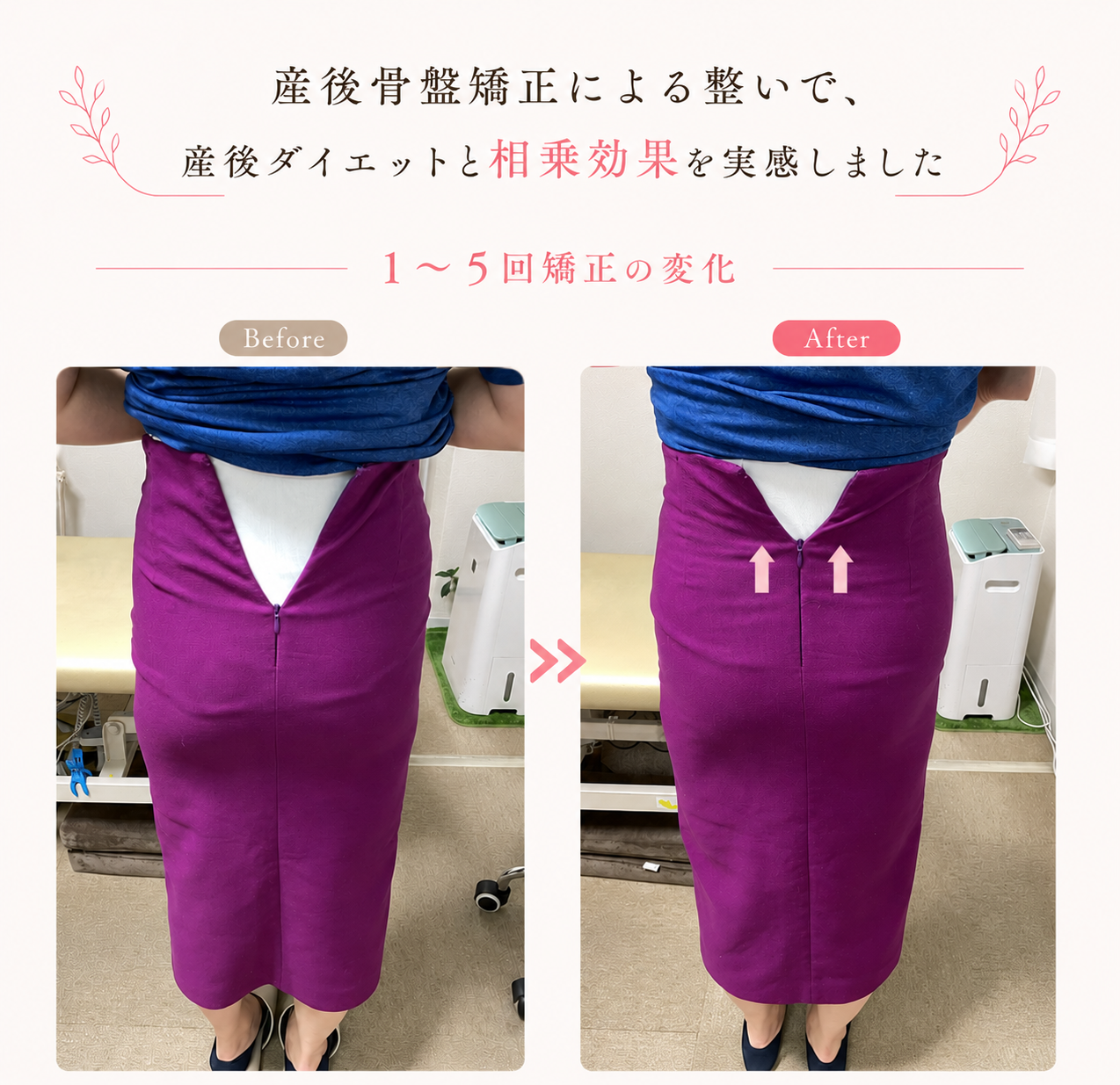 産後骨盤矯正1〜5回目の変化。産後ダイエットとの相乗効果で、閉まらなかったスカートのファスナーが上がるようになった様子