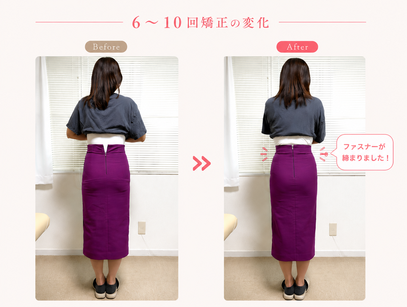 産後骨盤矯正6〜10回目のビフォーアフター。産後にきつくなったスカートのファスナーが完全に締まり、腰回りがサイズダウンした比較写真